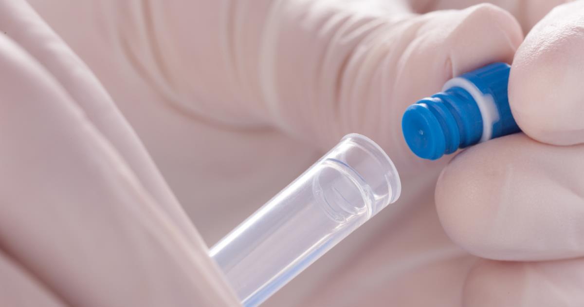 Laboratory automation Lab Services